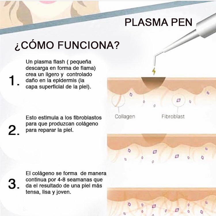 Cómo funciona el plasma pen